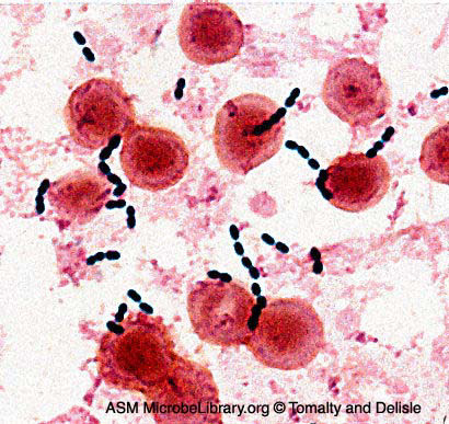 symptoms  enterococcus